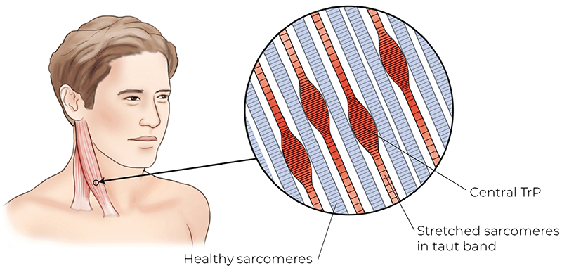 AUT_26_TissueTension2_800 AUT_26_TissueTension2_800
