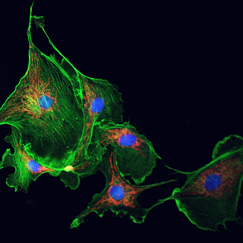 WIN_25_AnatomyForTouch4 The myofibroblasts under a microscope in color.