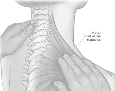 sketch pointing to motor point of the trapezius.