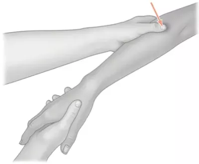 location of the large intestine 10 acupressure point in the arm.