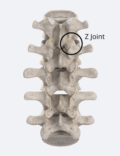 the z joint in the lumbar region accounts for low back pain