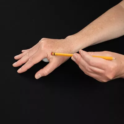 Demonstration of release of the adductor pollicis muscle by supporting the hand and using the eraser part of a pencil.