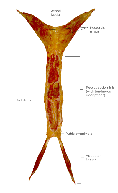 A dissection of muscle fascial connection crossing the body.