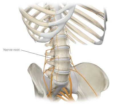 Illustration points to the nerve root in a posterior/lateral protrusion of the disc.