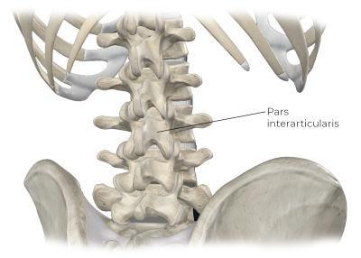 Illustration points to pars interarticularis.