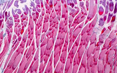 Microscopic view of human muscle tissue. 