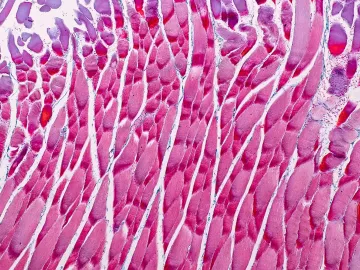 Microscopic view of human muscle tissue. 