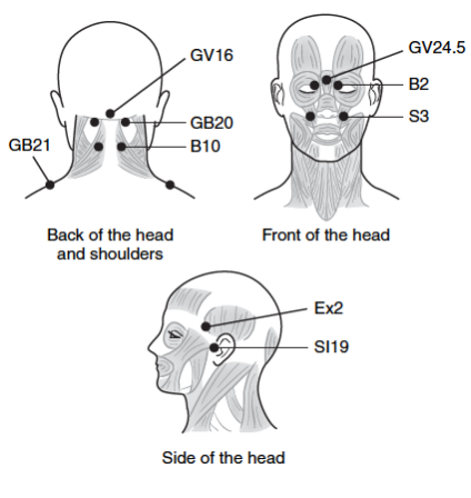 Diagram of headache relief pressure points.